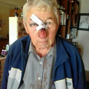 Bejaarde man van Joubertina op plaas in Oos-Kaap aangerand
