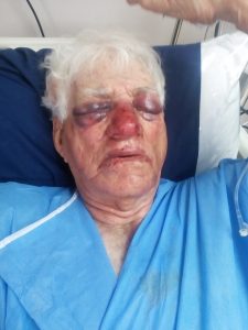 Bejaarde man met tuingraaf aangerand en in oë gespuit met plantgif tydens plaasaanval