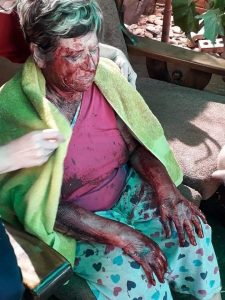 Vrou word wreed aangeval deur barbare in haar huis in Kuruman - beelde weerspieël die krisis wat blanke Suid-Afrikaners moet verduur in ons land