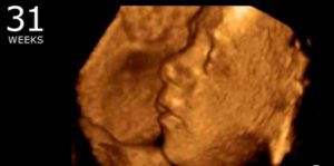 Suid-Afrikaanse dokter is van mediese praktyke verbied omdat hy aangeraai het dat aborsie die dood van 'n ongebore mens is!
